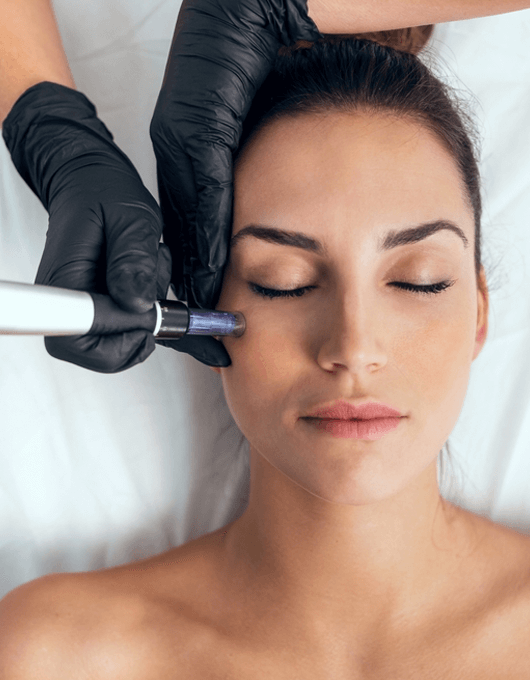 PLATELET RICH PLASMA (PRP)