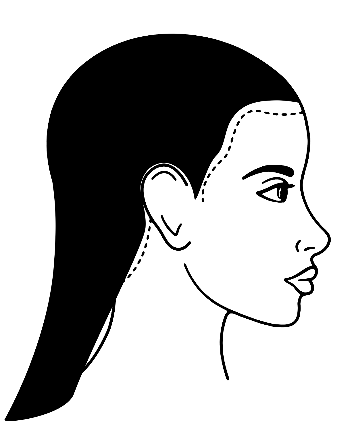 Scalp Micropigmentation