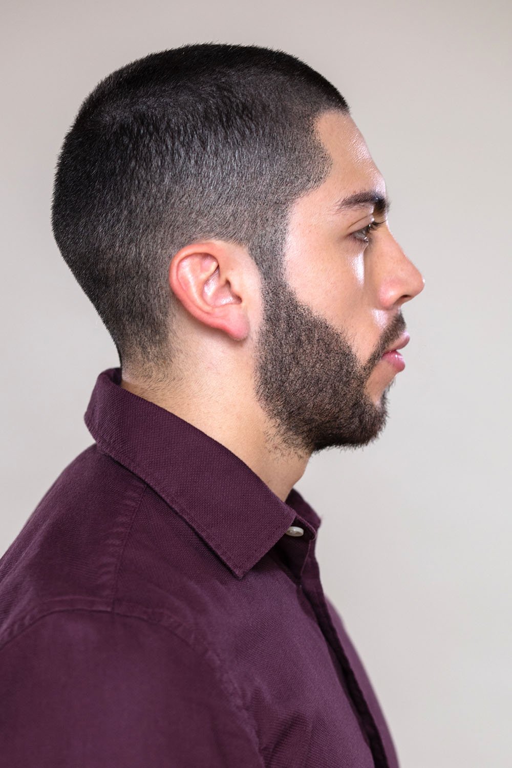 Scalp Micropigmentation