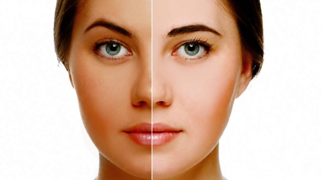 Skin Whitening Treatment in Dubai