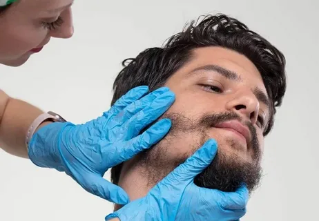 Beyond the Scalp: Precision Beard Hair Transplant Dubai and Eyebrow Design 3 beard hair transplant dubai