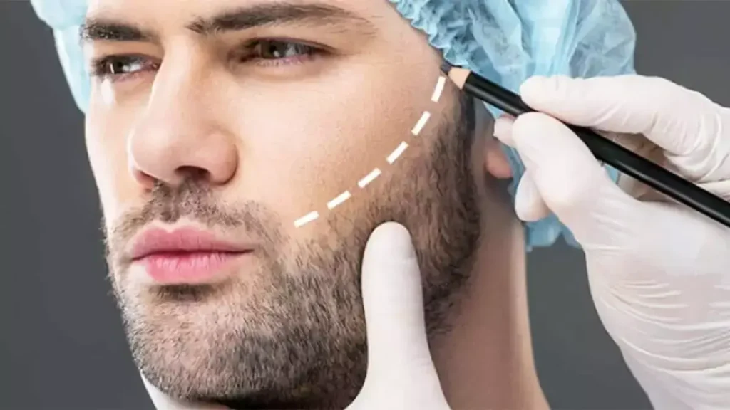 best hair transplant in dubai