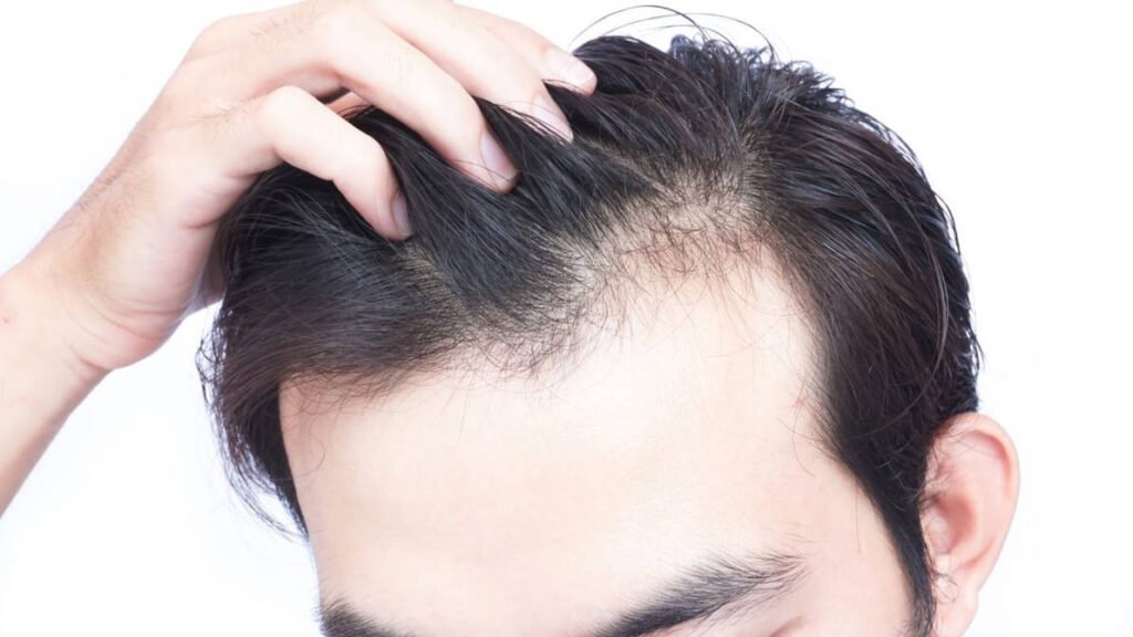 hair fall treatment for male
