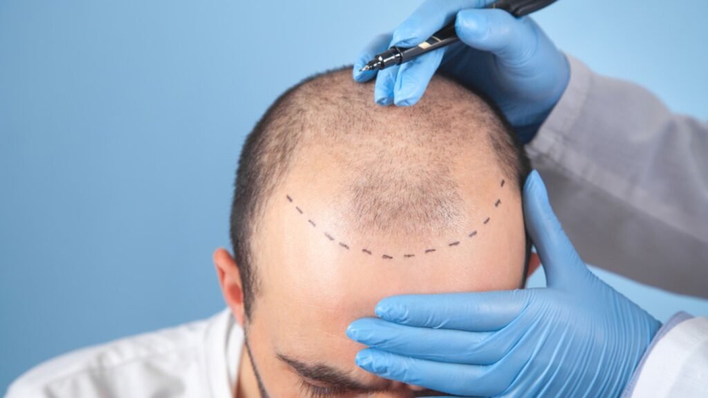 Dubai Healthcare City: Why It’s Becoming a Global Hub for Hair Transplants