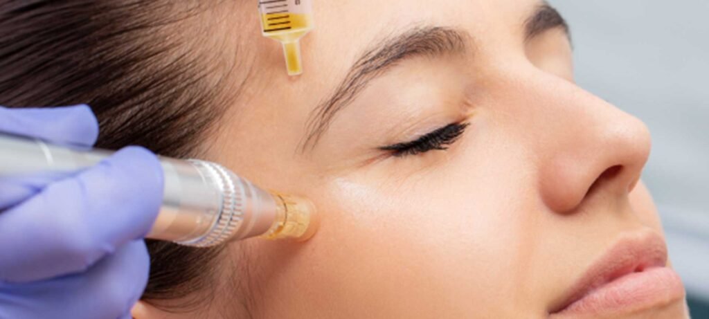 Exosomes for Skin Rejuvenation: What Results Can You Really Expect? 1 Exosomes for Skin Rejuvenation
