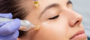 Exosomes for Skin Rejuvenation