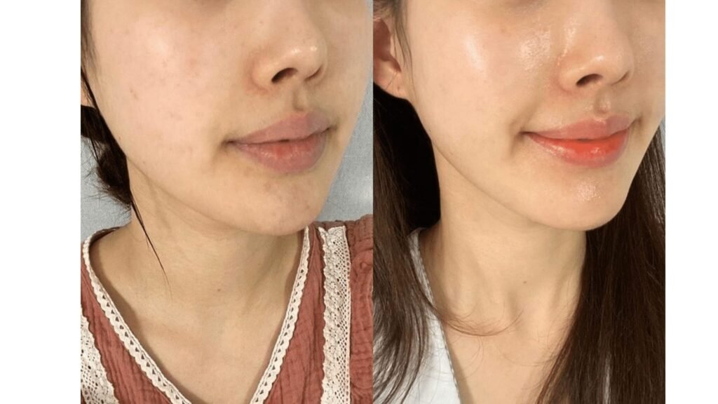 Exosomes for Skin Rejuvenation: What Results Can You Really Expect?