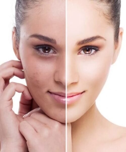 Skin Whitening Treatment1